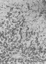 �ε�������