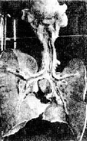 �ʺ������ܺ�֧����ճĤ�����м�Ĥ����