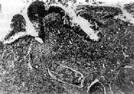 ֧��������֢