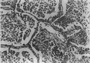 ��Ҷ�Է���