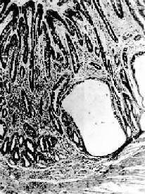 ����ή����θ��