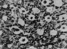 ����ϸ��<a href=