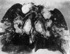 �ν��ԭ���ۺ����ͷ����ܰͽ���