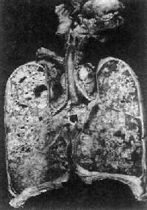 �ν��֧���ܲ�ɢ