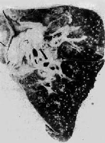 �������Խ�˲�