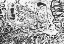 �λ�֧غ���没