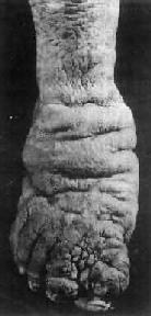 ˿�没���ڵ���֫��Ƥ��